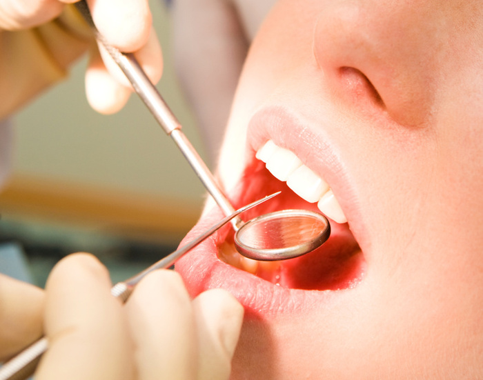 Dingy Teeth? A Cosmetic Dentist in Cincinnati, OH Can Help