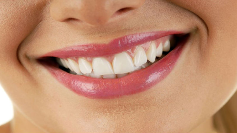 3 Essential Things to Know Before You Go for Teeth Whitening