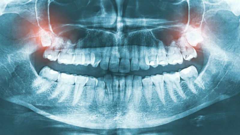 Reasons for Visiting a Dental Office for Dentistry in Macon, GA